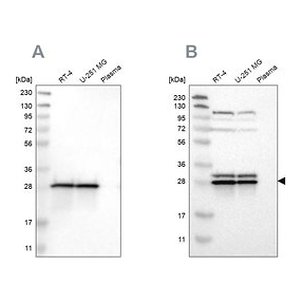 Merck Anti-ETFB antibody produced in rabbit