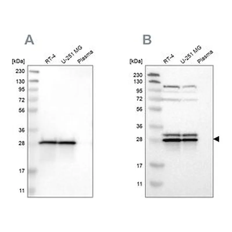 Merck Anti-ETFB antibody produced in rabbit
