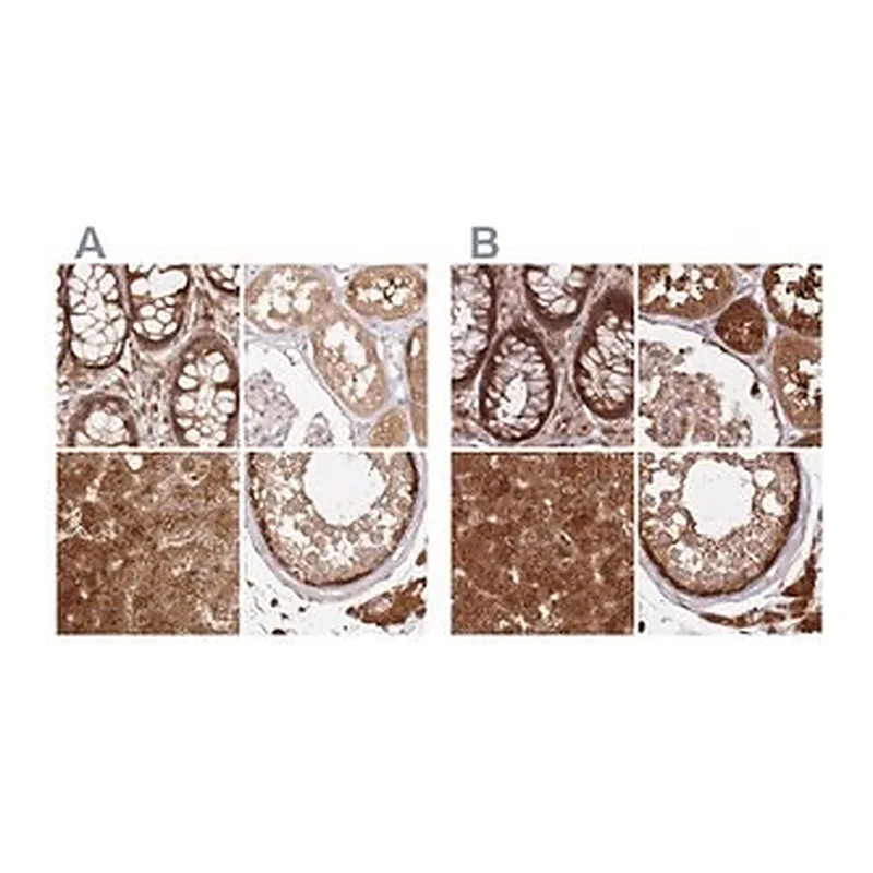Merck Anti-GBE1 antibody produced in rabbit