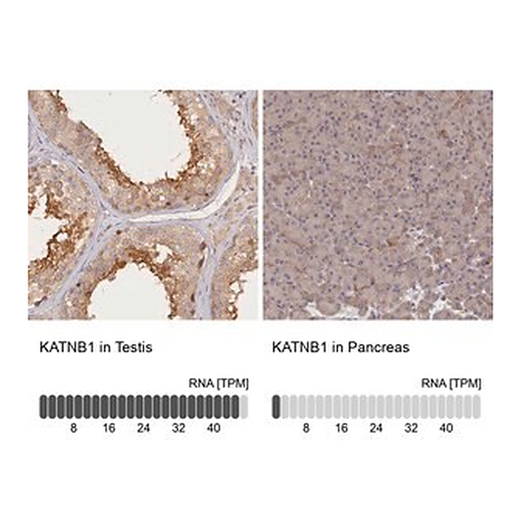 Merck Anti-KATNB1 antibody produced in rabbit