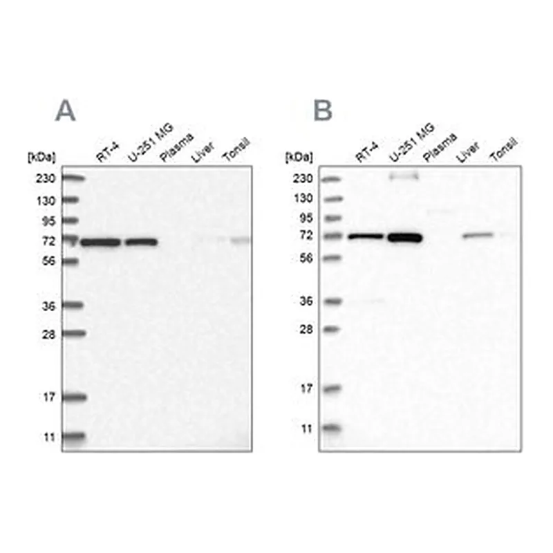 Merck Anti-AGPS antibody produced in rabbit