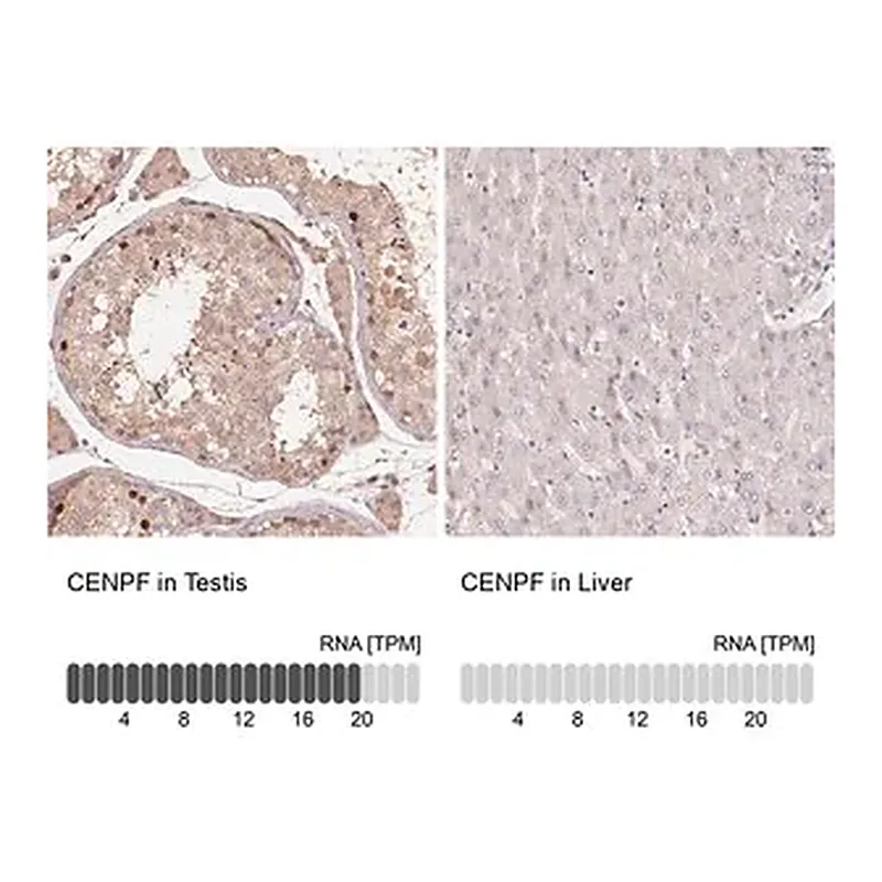Merck Anti-CENPF