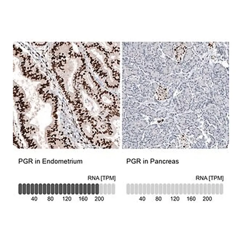 Merck Monoclonal Anti-PGR antibody produced in mouse