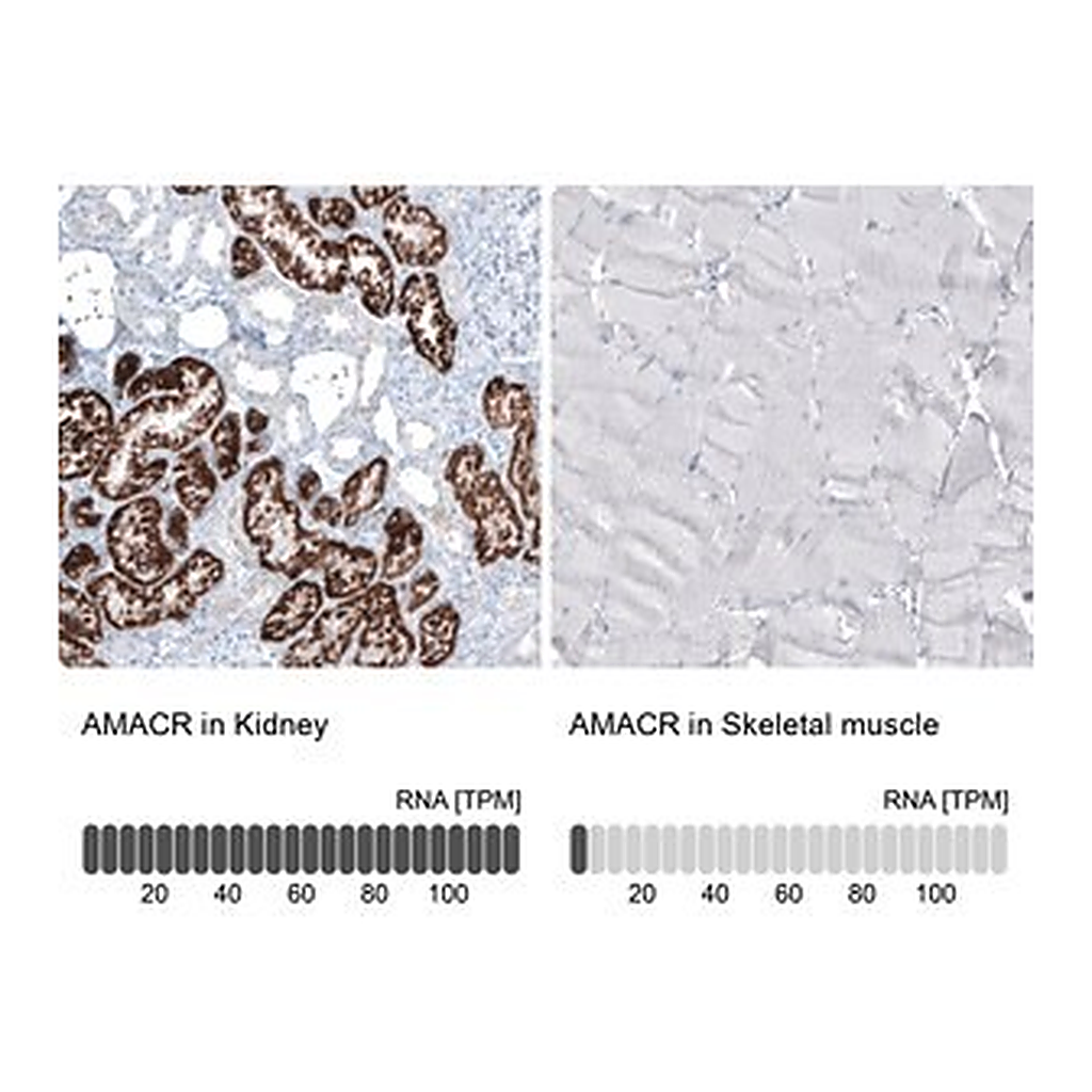 Merck Monoclonal Anti-AMACR antibody produced in mouse