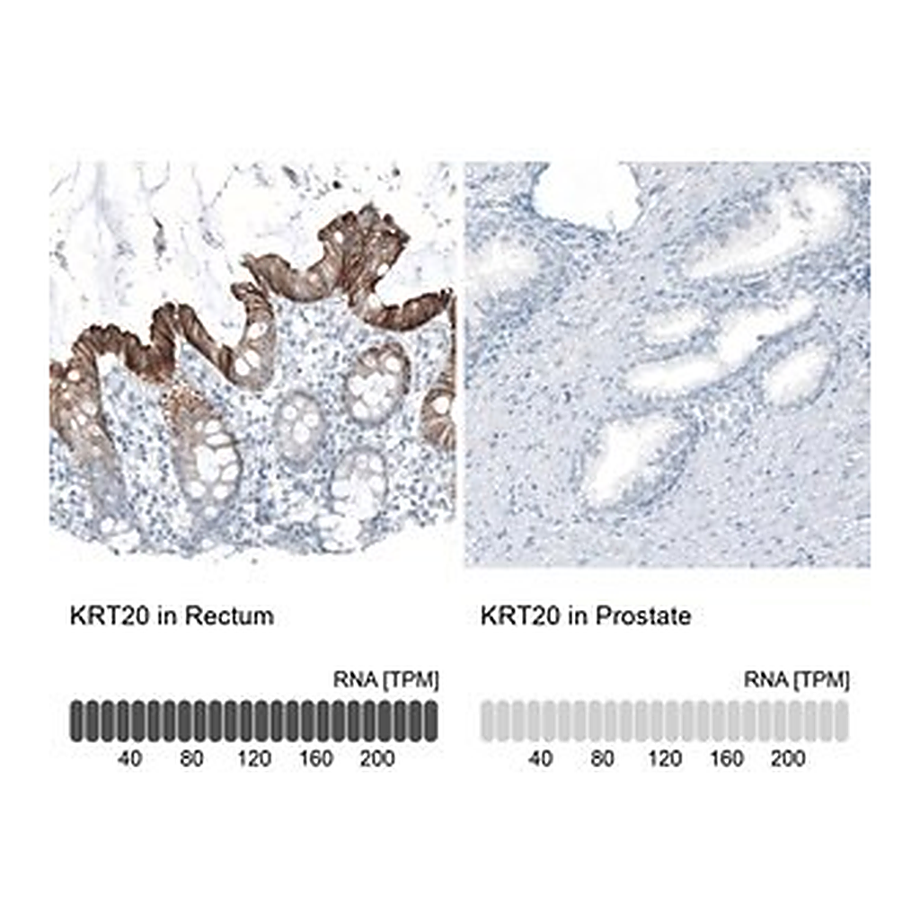 Merck Monoclonal Anti-KRT20 antibody produced in mouse