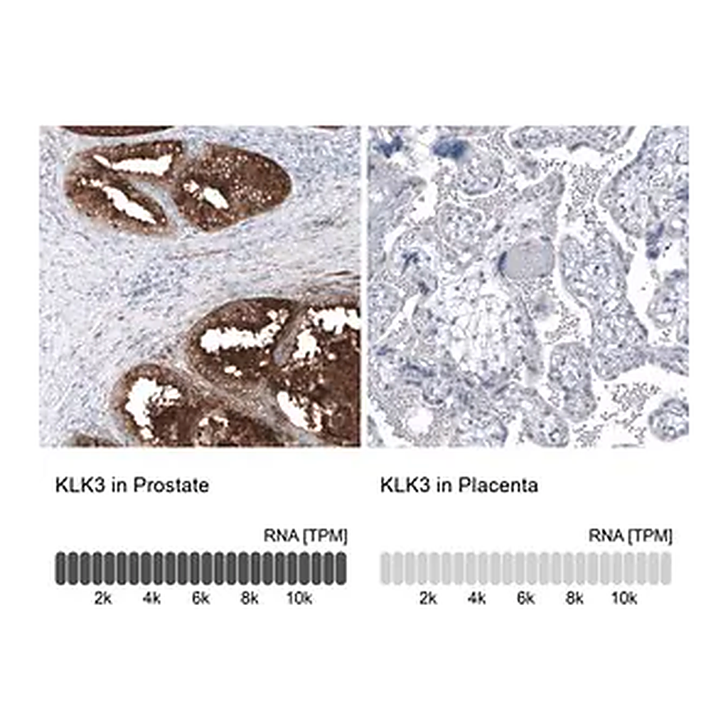 Merck Monoclonal Anti-KLK3 antibody produced in mouse
