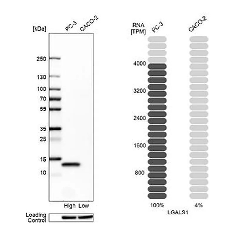Merck Anti-LGALS1