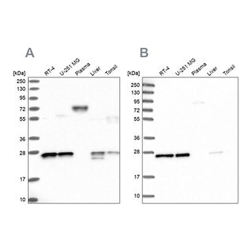 Merck Anti-MESDC2