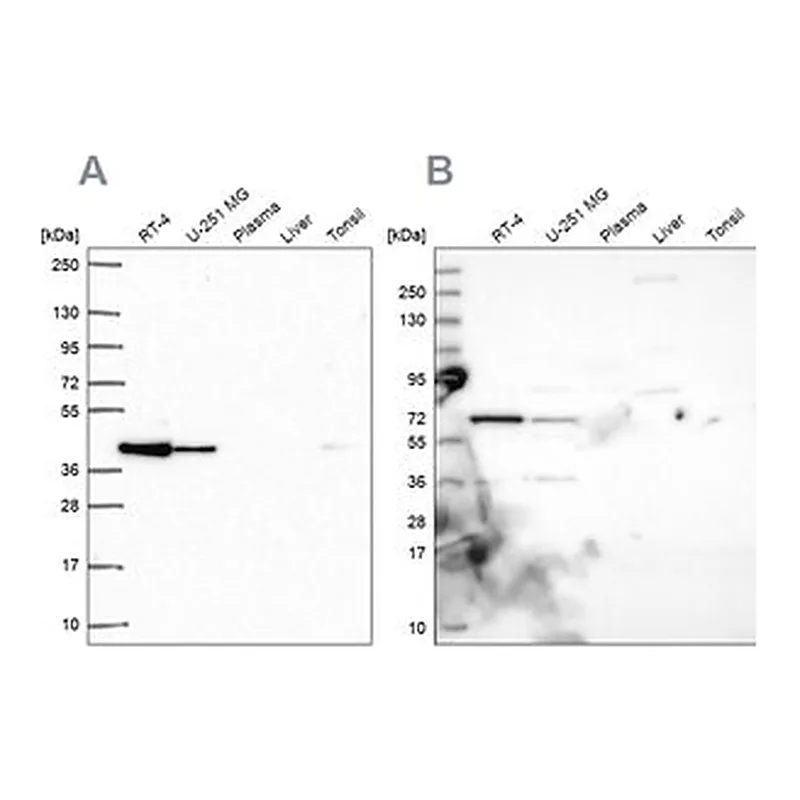 Merck Anti-GIPC1