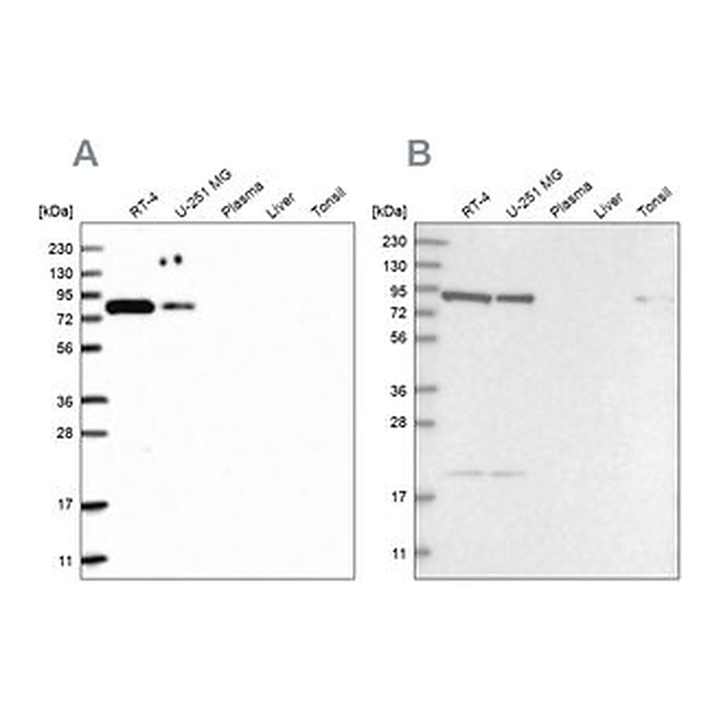Merck Anti-CHML antibody produced in rabbit