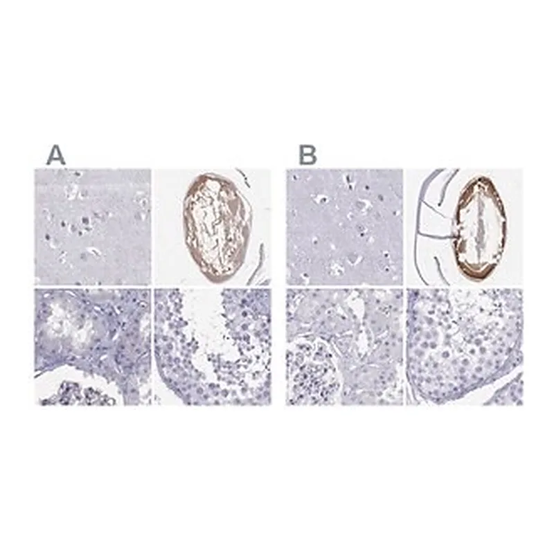Merck Anti-GJA8 antibody produced in rabbit