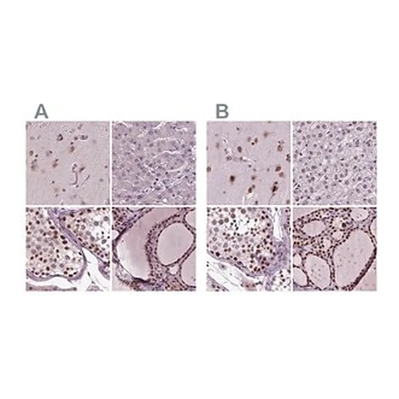 Merck Anti-RCOR3 antibody produced in rabbit