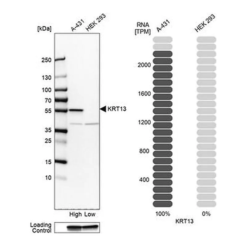 Merck Anti-KRT13 antibody produced in rabbit