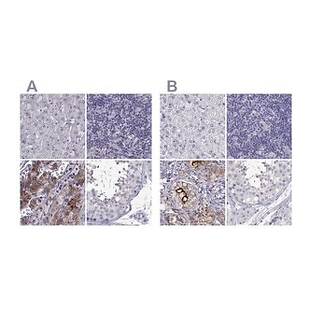 Merck Anti-IGSF1 antibody produced in rabbit