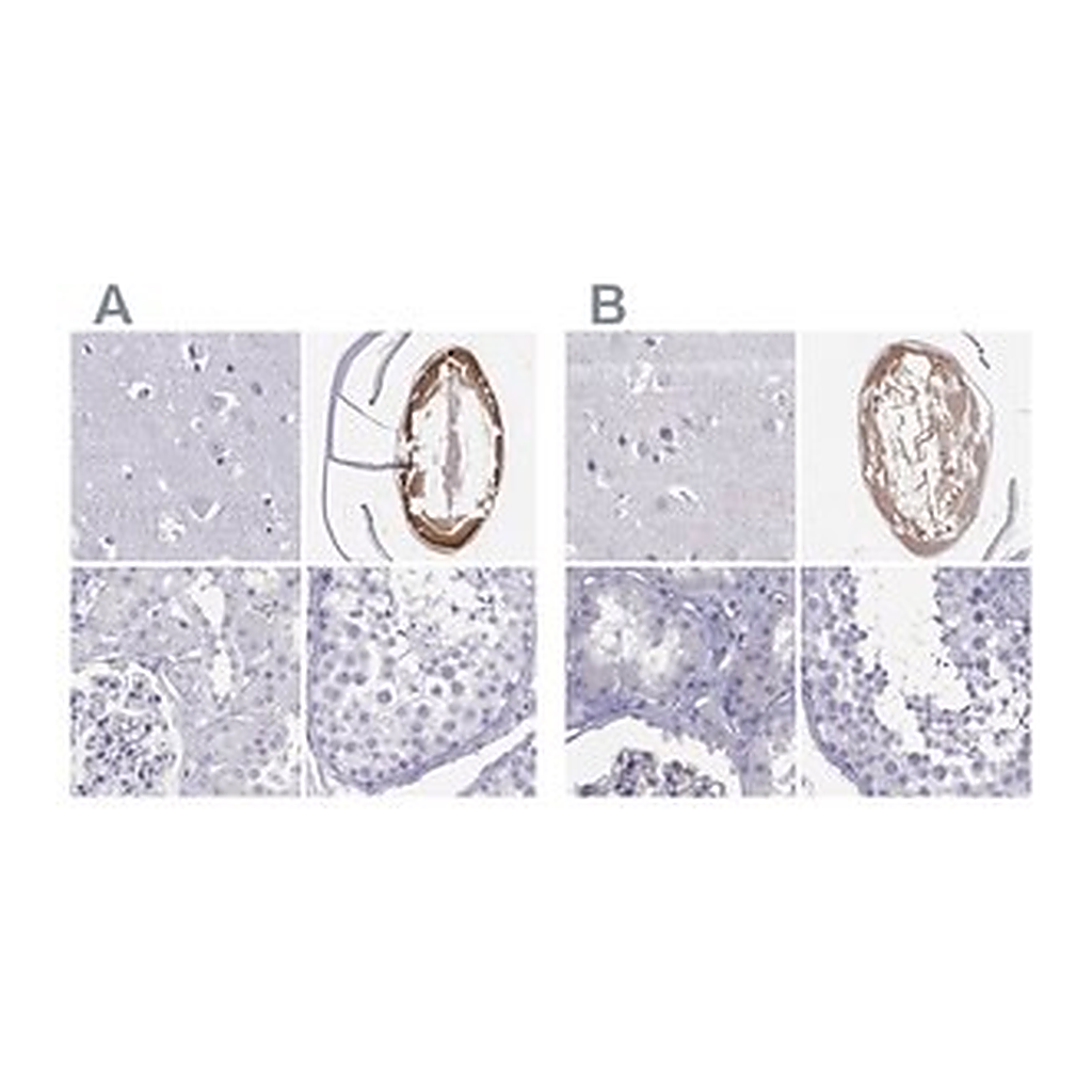 Merck Anti-GJA8 antibody produced in rabbit