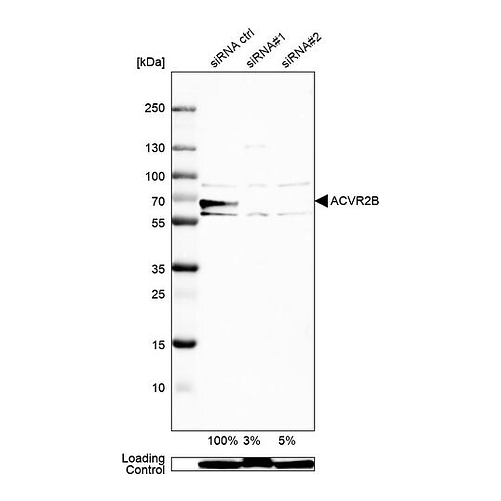 Merck Anti-ACVR2B antibody produced in rabbit