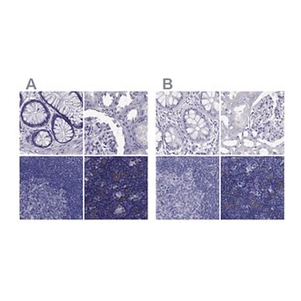 Merck Anti-PSMB11 antibody produced in rabbit