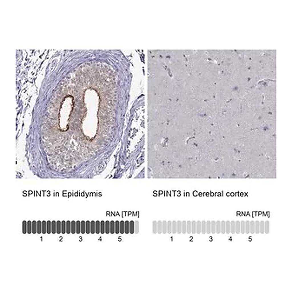 Merck Anti-SPINT3