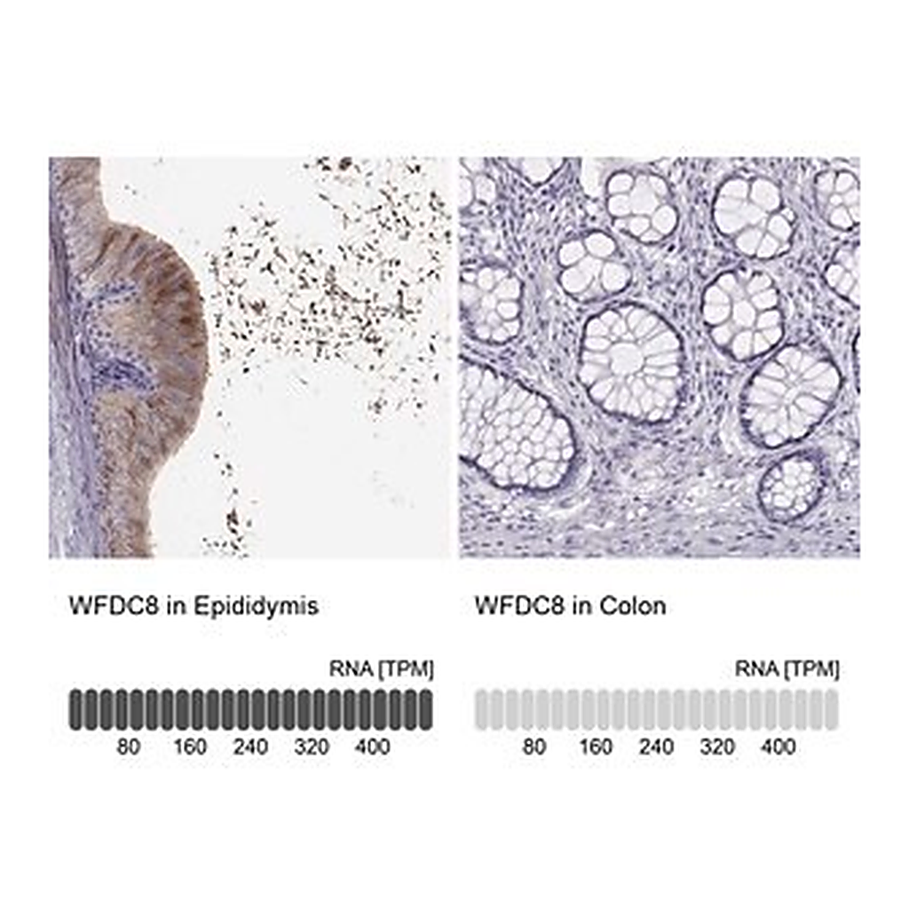 Merck Anti-WFDC8