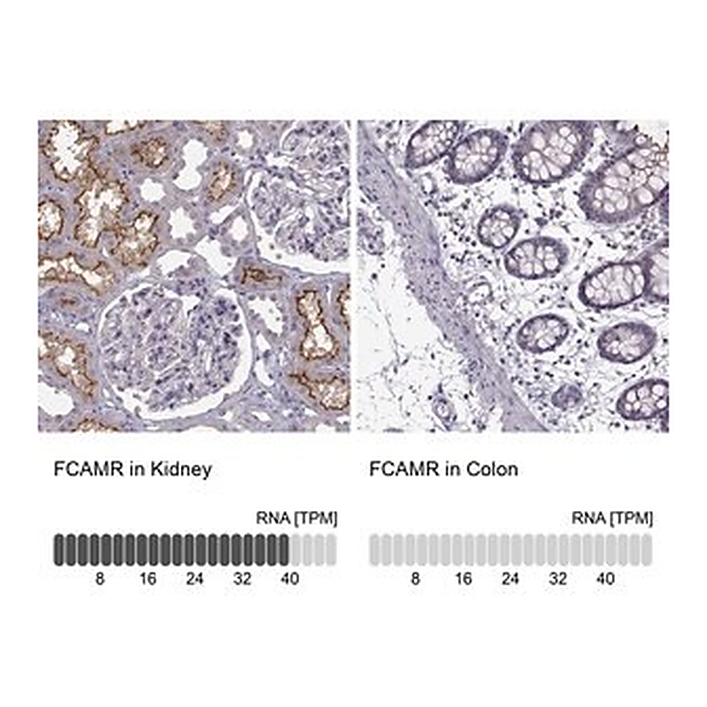 Merck Anti-FCAMR