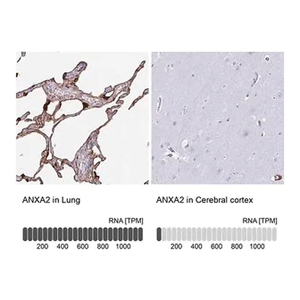 Merck Anti-ANXA2