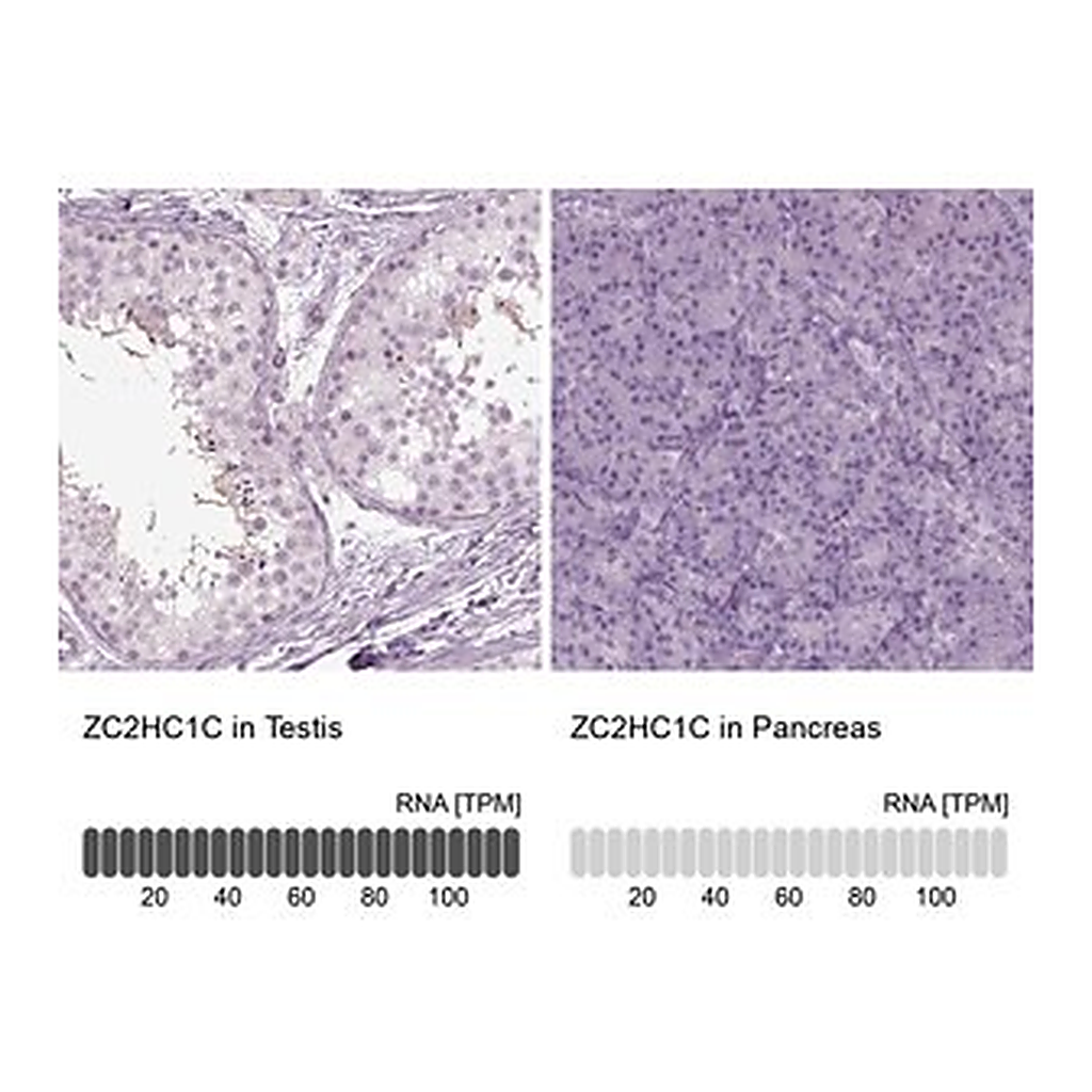 Merck Anti-ZC2HC1C