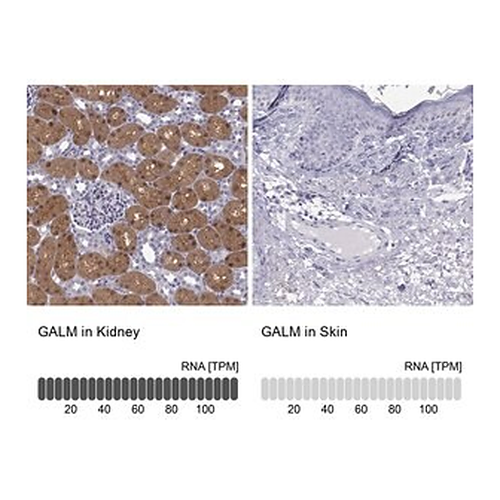 Merck Anti-GALM