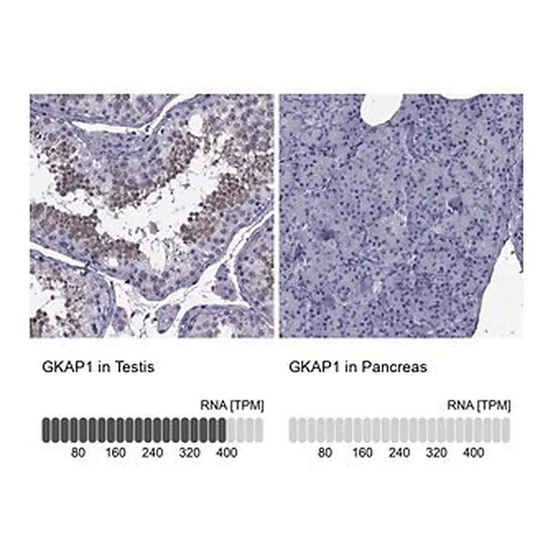 Merck Anti-GKAP1