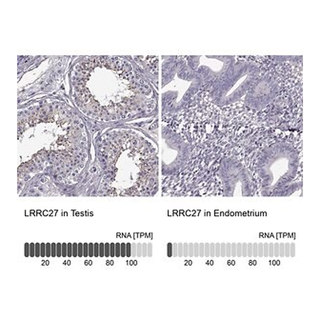 Merck Anti-LRRC27