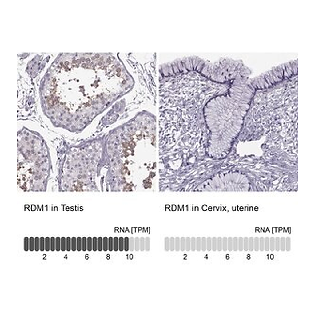 Merck Anti-RDM1