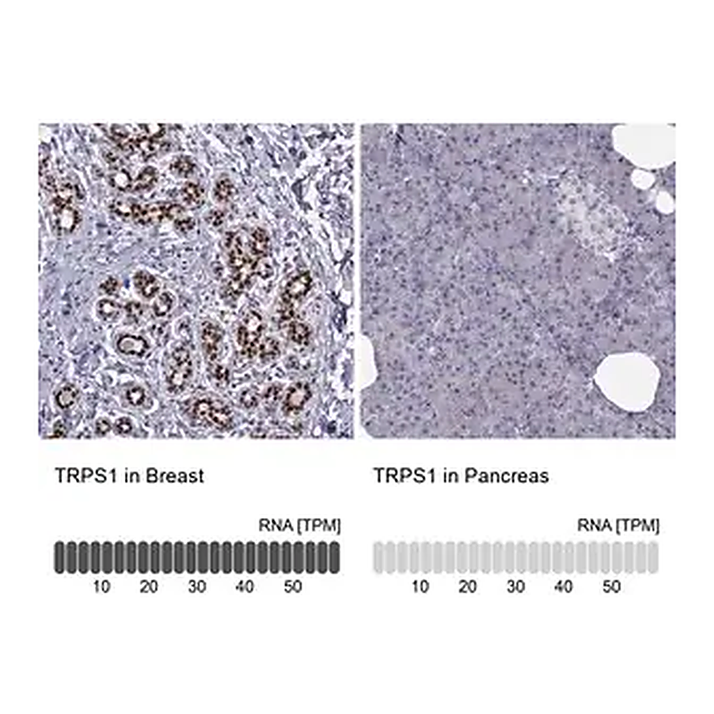 Merck Anti-TRPS1