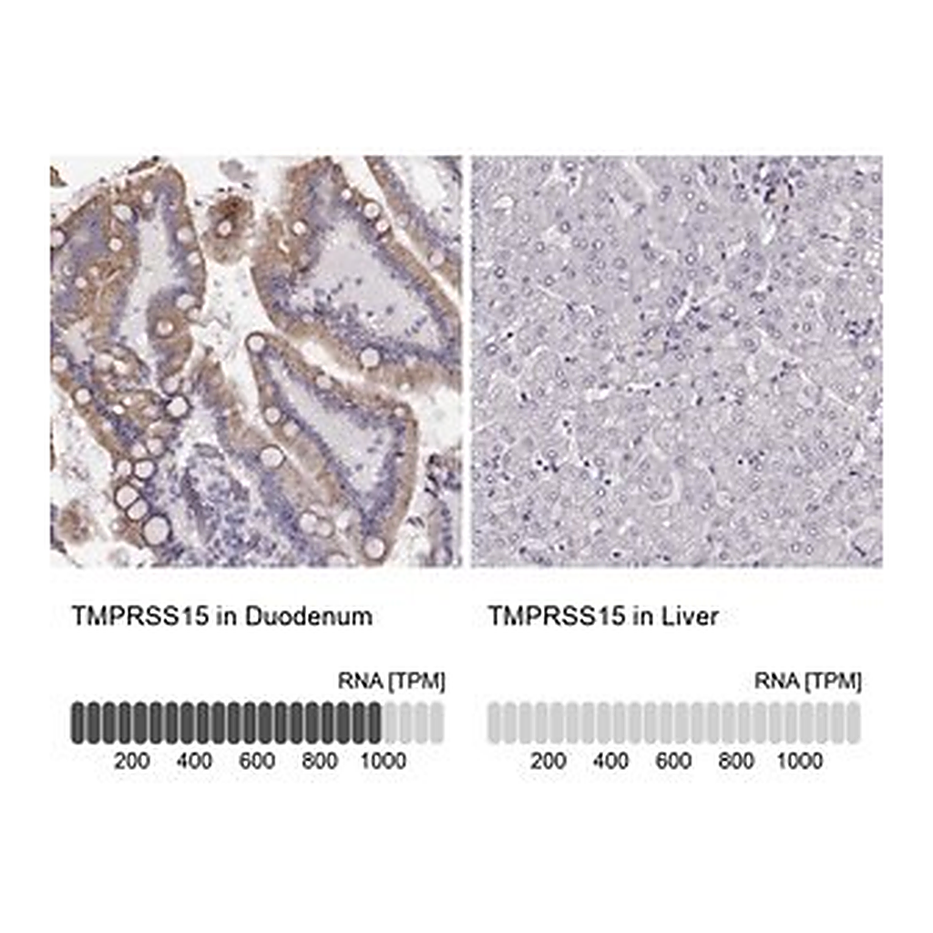 Merck Anti-TMPRSS15