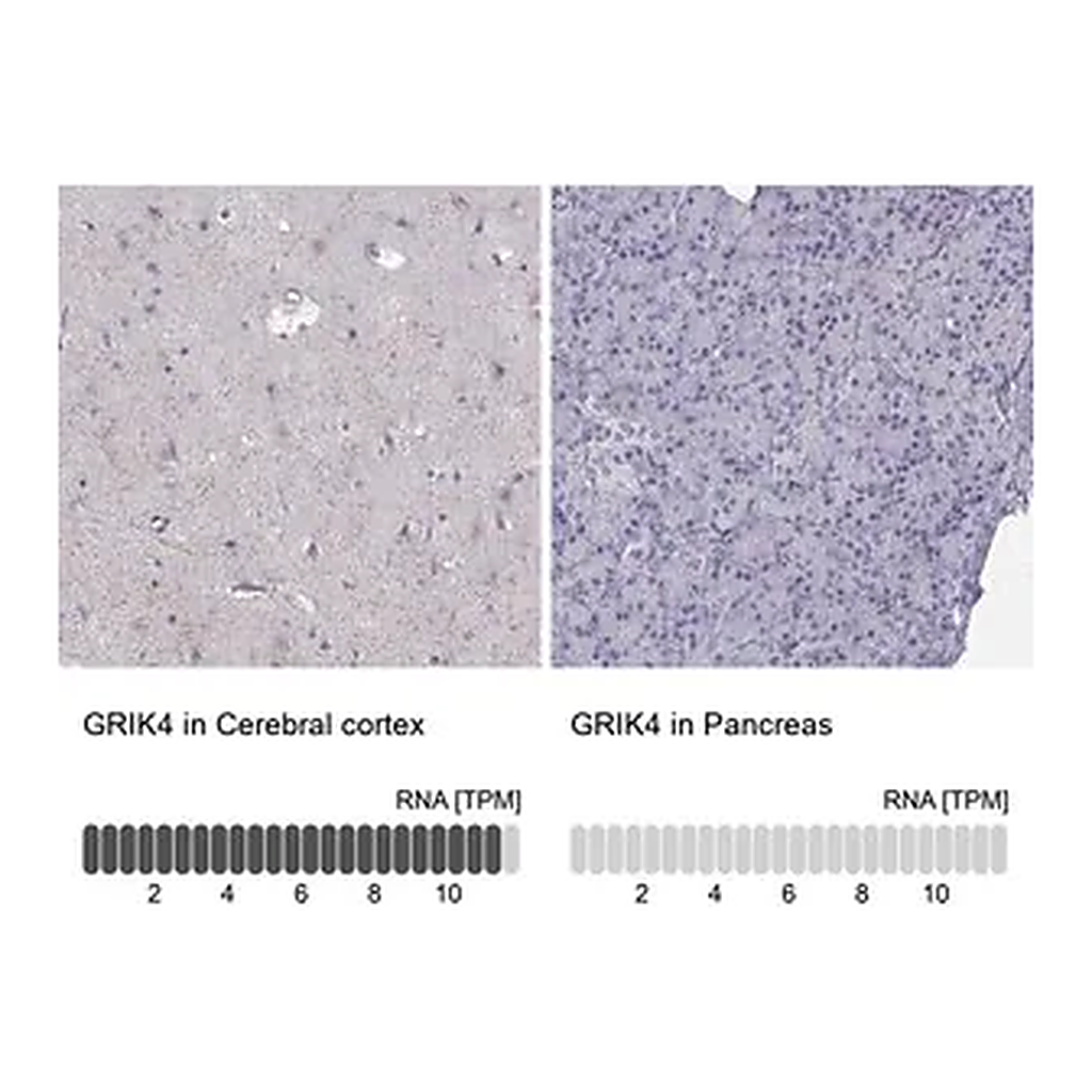 Merck Anti-GRIK4