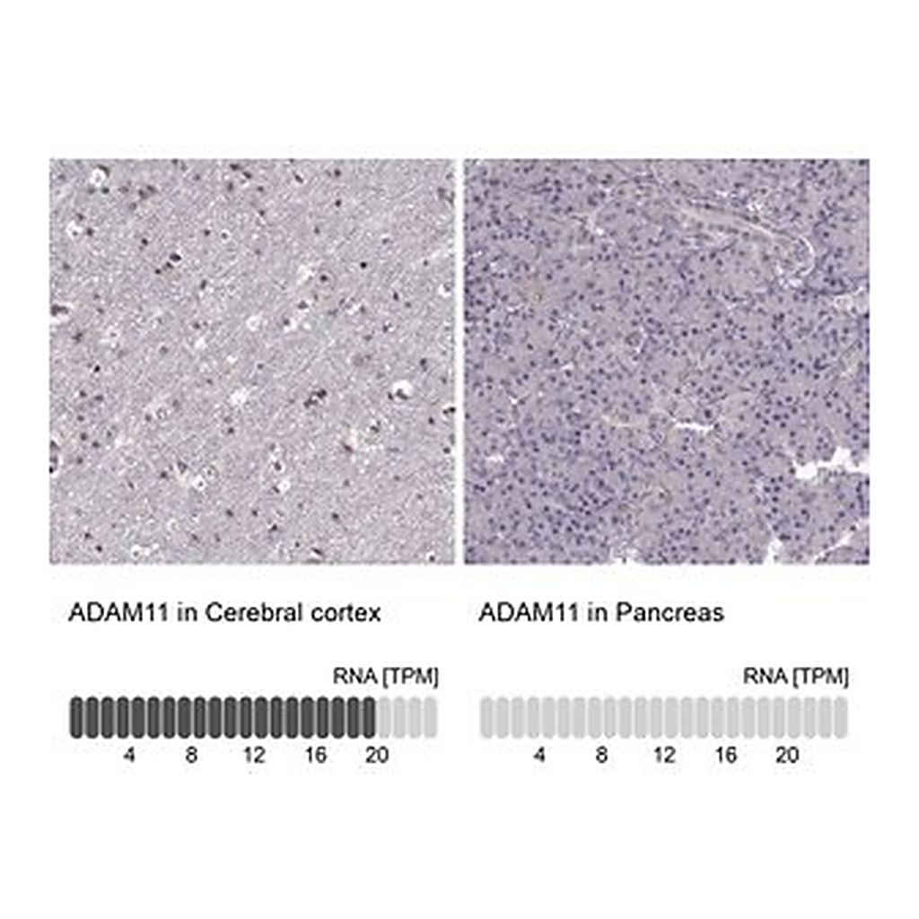 Merck Anti-ADAM11