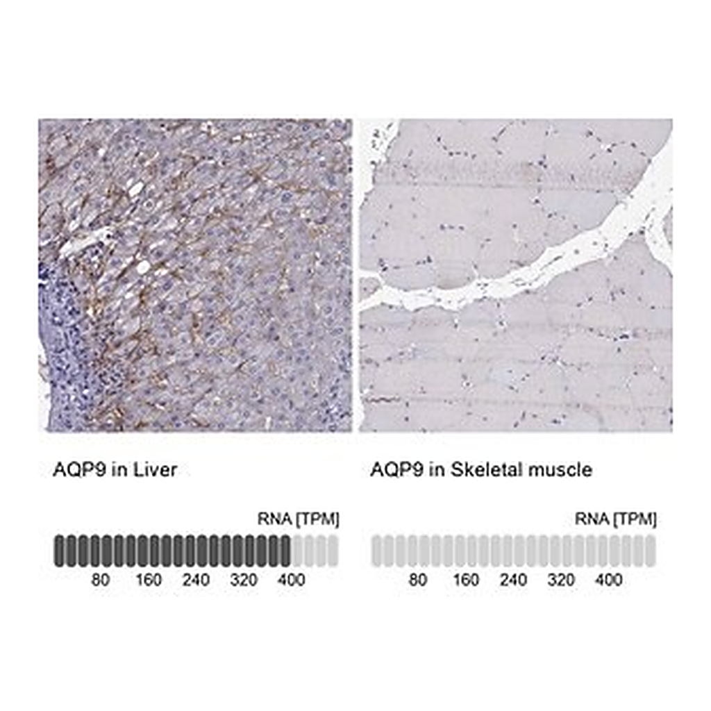 Merck Anti-AQP9