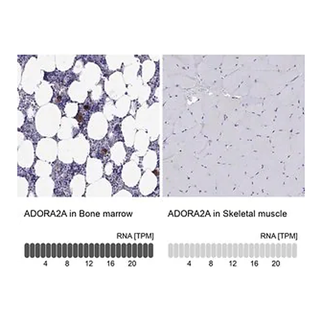 Merck Anti-ADORA2A