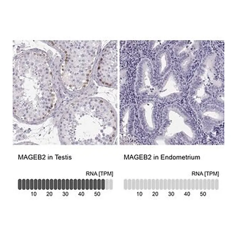 Merck Anti-MAGEB2