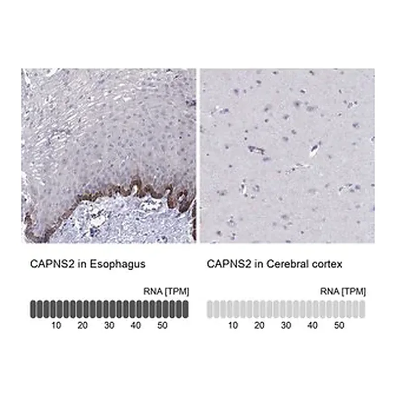 Merck Anti-CAPNS2