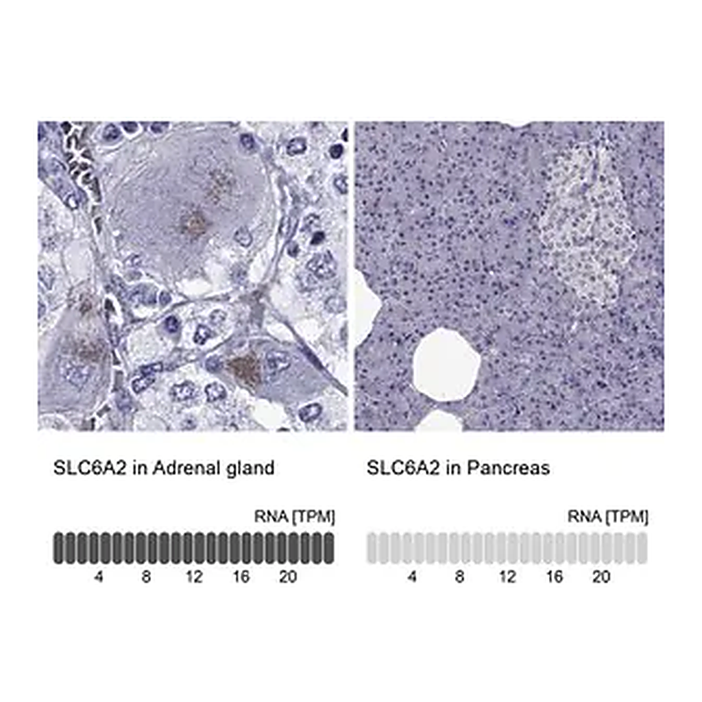 Merck Anti-SLC6A2