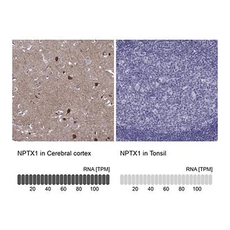Merck Anti-NPTX1