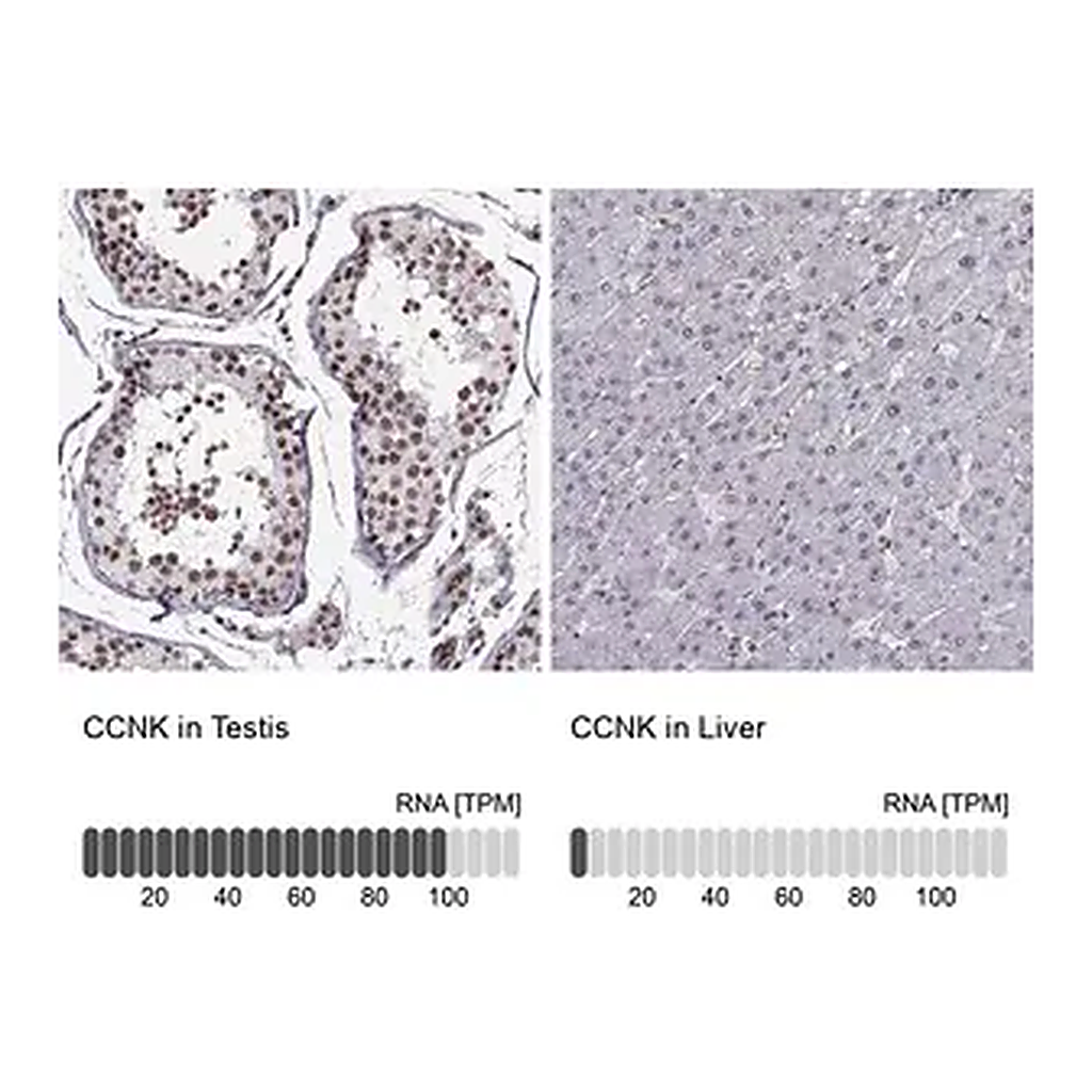 Merck Anti-CCNK