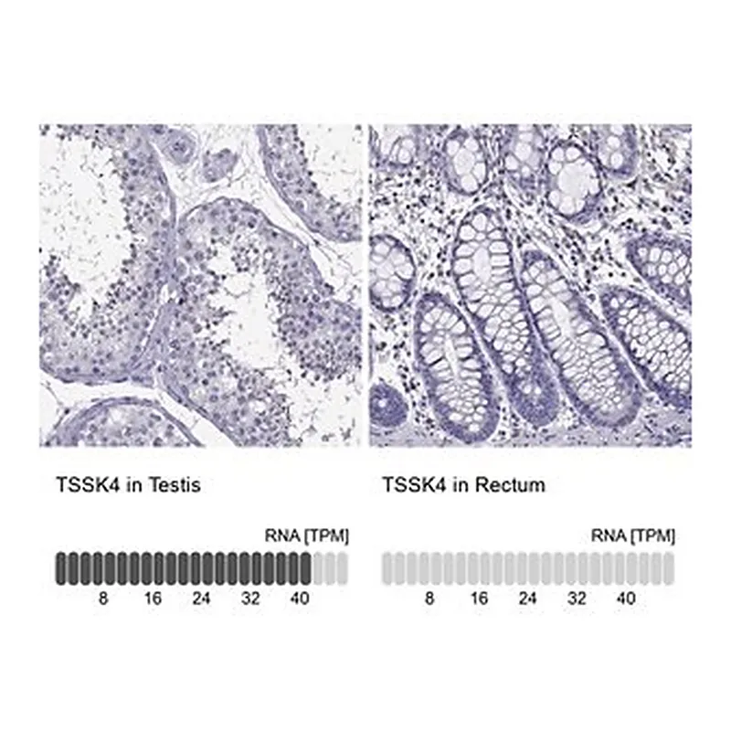 Merck Anti-TSSK4