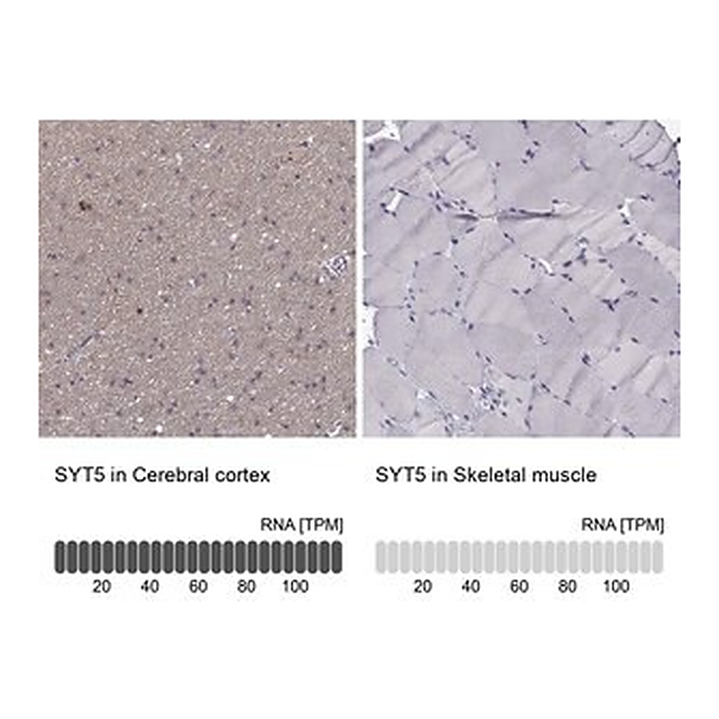 Merck Anti-SYT5