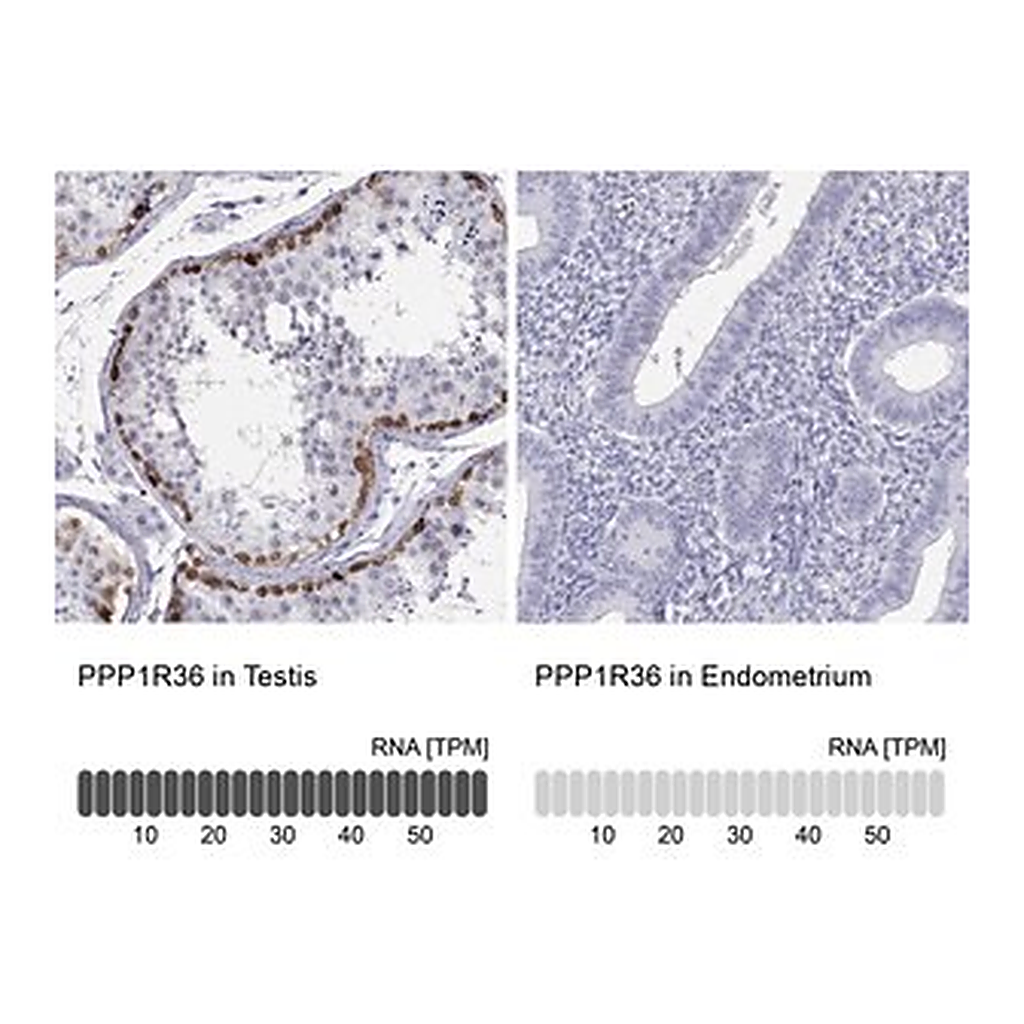 Merck Anti-PPP1R36