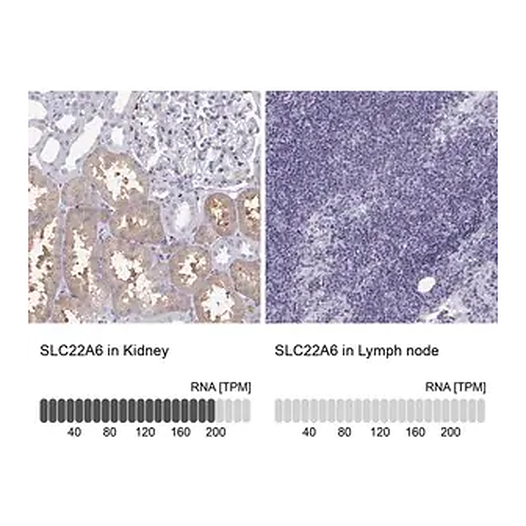 Merck Anti-SLC22A6