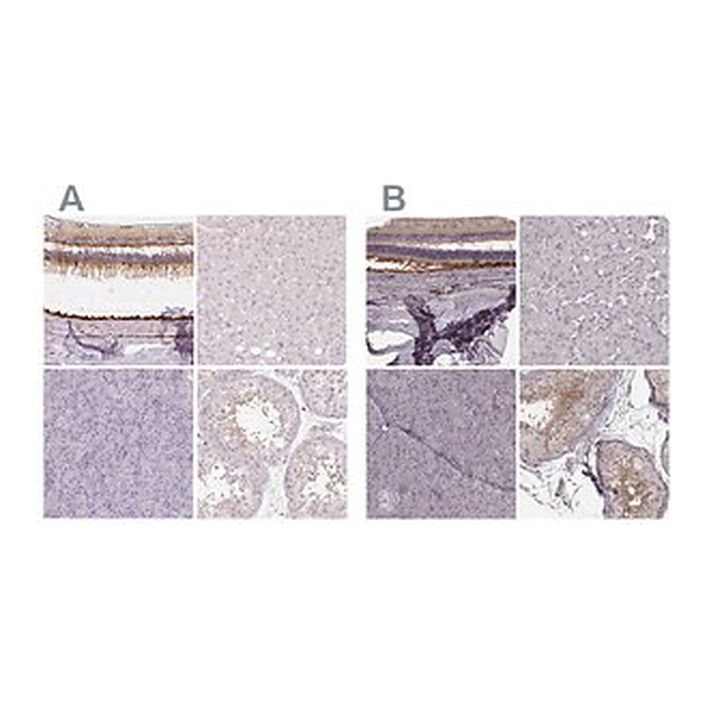 Merck Anti-RPGRIP1 antibody produced in rabbit
