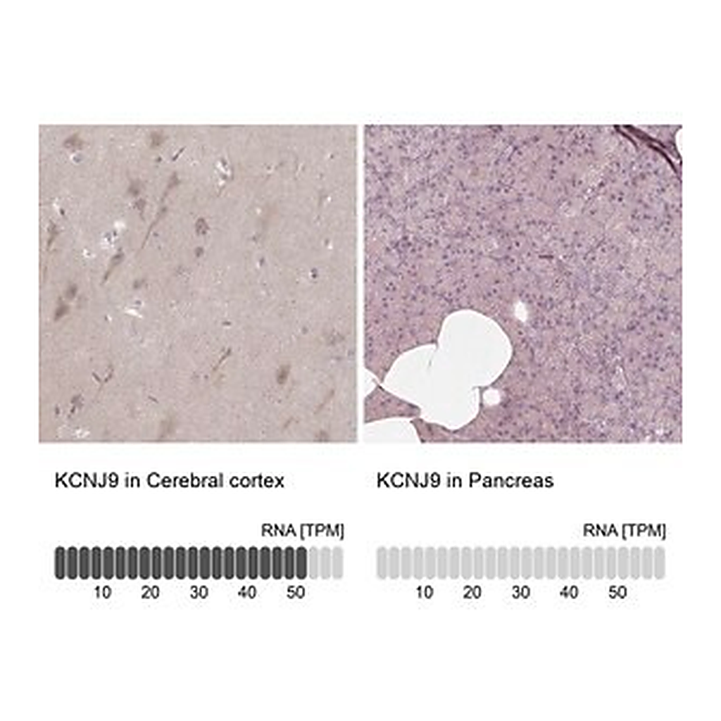 Merck Anti-KCNJ9 antibody produced in rabbit