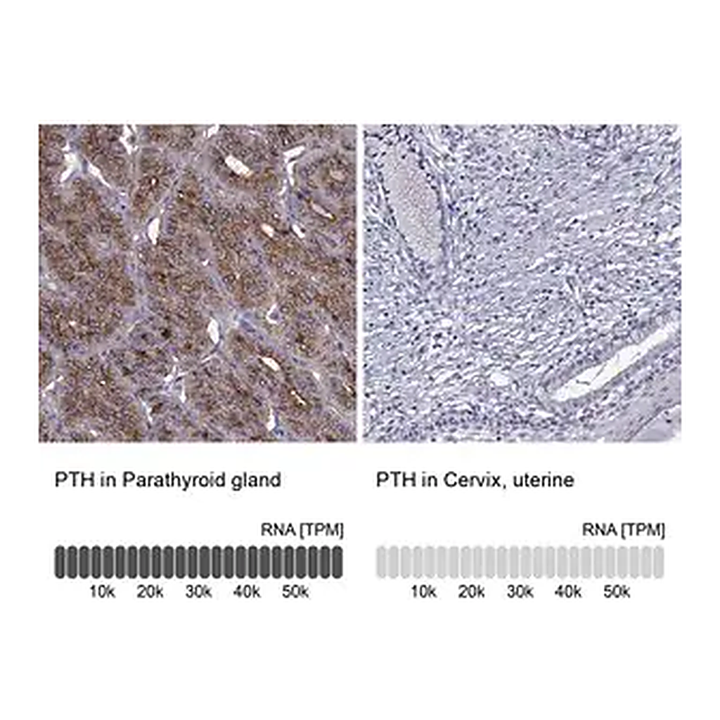 Merck Anti-PTH antibody produced in rabbit