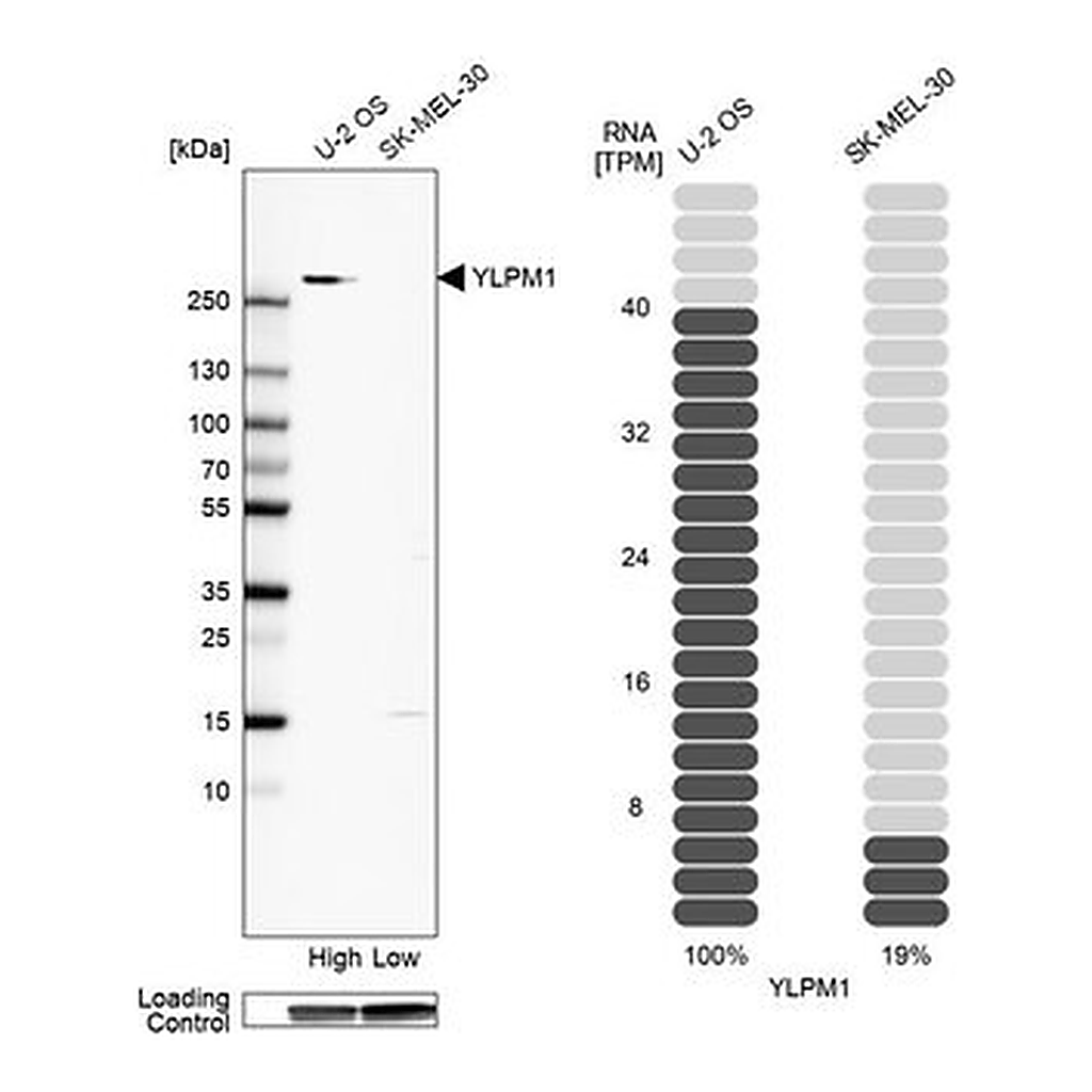 Merck Anti-YLPM1 antibody produced in rabbit