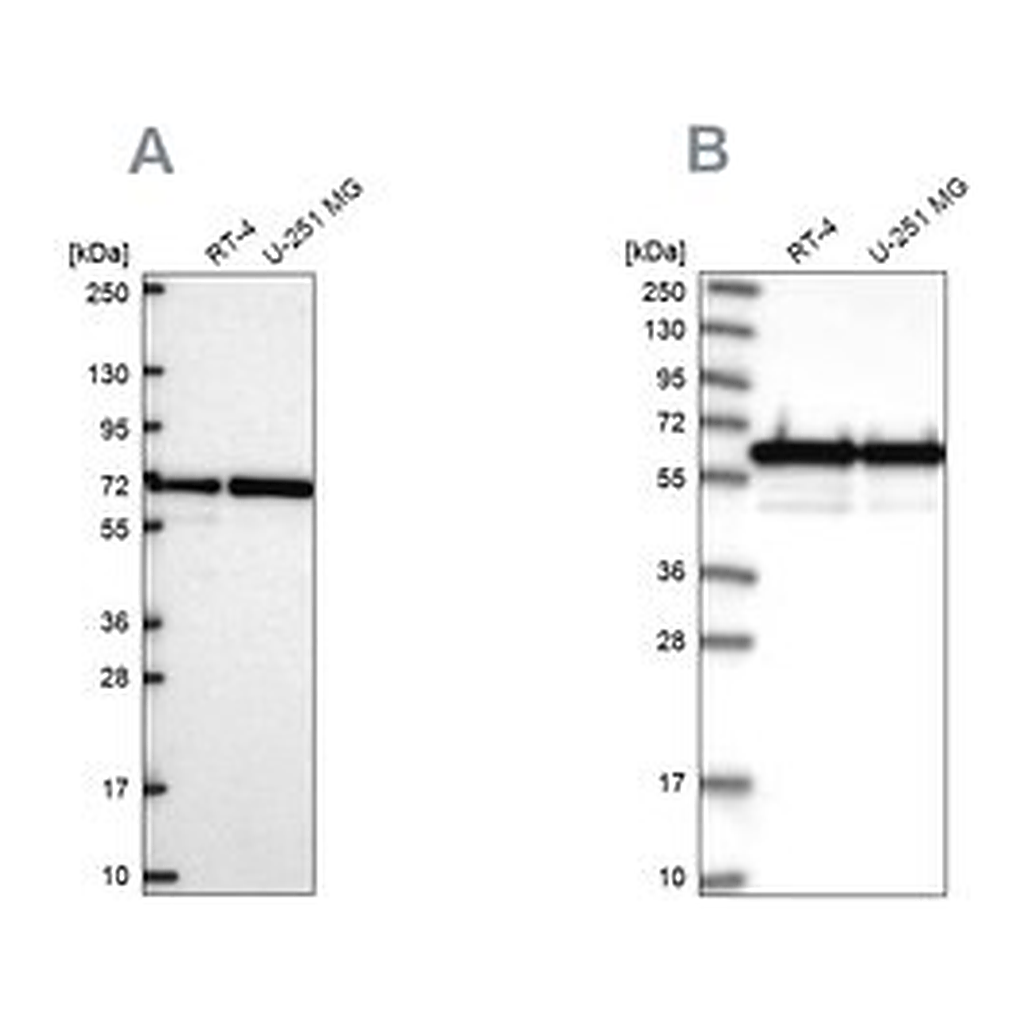Merck Anti-CCDC47 antibody produced in rabbit
